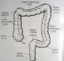 Localizzazioni tumori colon
